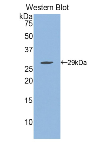 IFNAR1 / IFNAR Antibody - Western blot of recombinant IFNAR1 / IFNAR.  This image was taken for the unconjugated form of this product. Other forms have not been tested.