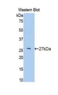 IFNAR1 / IFNAR Antibody - Western blot of recombinant IFNAR1 / IFNAR.  This image was taken for the unconjugated form of this product. Other forms have not been tested.