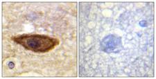 IFNAR1 / IFNAR Antibody - Immunohistochemistry analysis of paraffin-embedded human brain tissue, using Interferon-alpha/beta Receptor alpha chain Antibody. The picture on the right is blocked with the synthesized peptide.