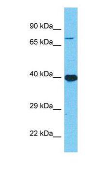 IFNAR1 / IFNAR Antibody - Western blot of IFNAR1 Antibody with human OVCAR-3 Whole Cell lysate.  This image was taken for the unconjugated form of this product. Other forms have not been tested.