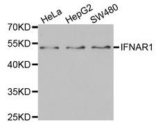 IFNAR1 / IFNAR Antibody - Western blot analysis of extracts of various cell lines.