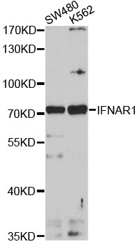 IFNAR1 / IFNAR Antibody - Western blot analysis of extracts of various cell lines, using IFNAR1 antibody at 1:1000 dilution. The secondary antibody used was an HRP Goat Anti-Rabbit IgG (H+L) at 1:10000 dilution. Lysates were loaded 25ug per lane and 3% nonfat dry milk in TBST was used for blocking. An ECL Kit was used for detection and the exposure time was 90s.