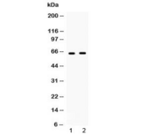 IFNAR1 / IFNAR Antibody - Western blot testing of 1) human HeLa and 2) mouse NIH3T3 cell lysate with IFNAR1 antibody at 0.5ug/ml. Predicted molecular weight ~64 kDa.