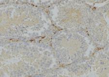 IFNAR1 / IFNAR Antibody - 1:100 staining mouse testis tissue by IHC-P. The sample was formaldehyde fixed and a heat mediated antigen retrieval step in citrate buffer was performed. The sample was then blocked and incubated with the antibody for 1.5 hours at 22°C. An HRP conjugated goat anti-rabbit antibody was used as the secondary.