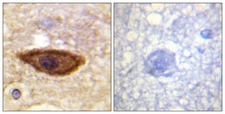 IFNAR1 / IFNAR Antibody - Peptide - + Immunohistochemistry analysis of paraffin-embedded human brain tissue using Interferon-a/ß Receptor a chain antibody.