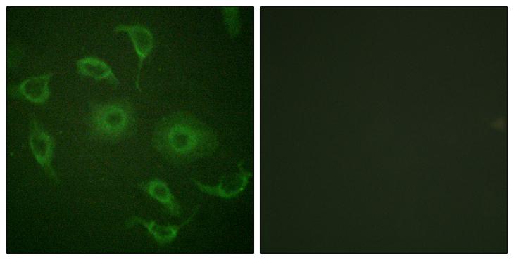 IFNAR1 / IFNAR Antibody - Peptide - + Immunofluorescence analysis of HepG2 cells, using Interferon-a/ß Receptor a chain antibody.