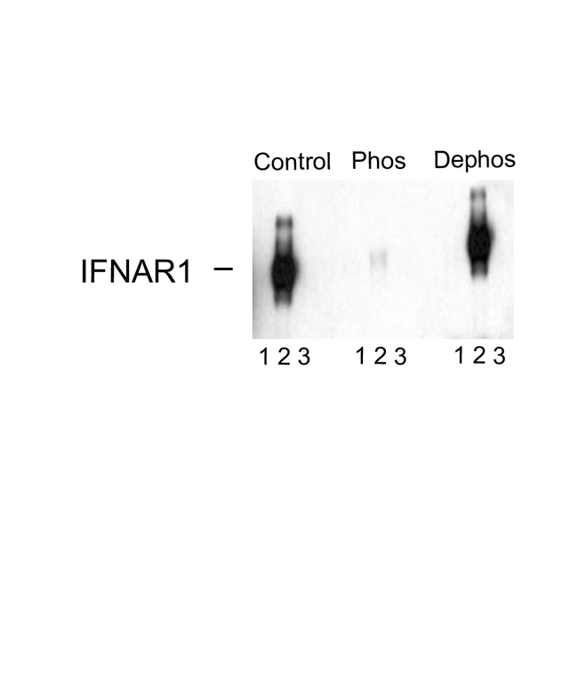 IFNAR1 / IFNAR Antibody - Western blot of immunoprecipitates from HEK 293 cells transfected with 1. Mock, 2. IFNAR1 WT, and 3. IFNAR1 S535A and S539A mutants showing specific immunolabeling of the ~110k to ~130k IFNAR1 WT. The immunolabeling is absent in IFNAR1 Ser535 and Ser539 mutants (Control). The immunolabeling is blocked by the phosphopeptide (Phos) used as the antigen but not by the corresponding dephosphopeptide (Dephos).