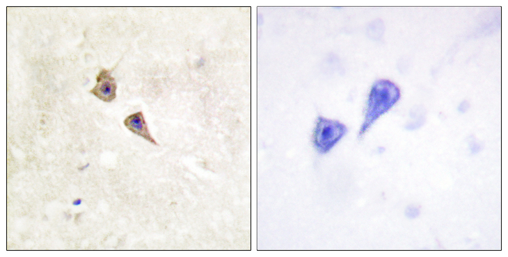IFNAR1 / IFNAR Antibody - Immunohistochemistry analysis of paraffin-embedded human brain, using Interferon-alpha/beta Receptor alpha (Phospho-Tyr466) Antibody. The picture on the right is blocked with the phospho peptide.