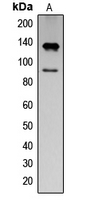 IFNAR1 / IFNAR Antibody - Western blot analysis of IFNAR1 (pY466) expression in K562 EGF-treated (A) whole cell lysates.