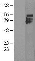 IFNAR1 / IFNAR Protein - Western validation with an anti-DDK antibody * L: Control HEK293 lysate R: Over-expression lysate