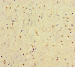 IFNAR2 Antibody - Immunohistochemistry of paraffin-embedded human smooth muscle tissue using IFNAR2 Antibody at dilution of 1:100