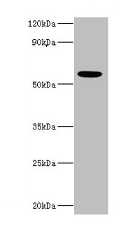 IFNAR2 Antibody - Western blot All lanes: IFNAR2 antibody at 10µg/ml + MCF-7 whole cell lysate Secondary Goat polyclonal to rabbit IgG at 1/10000 dilution Predicted band size: 58, 38, 28 kDa Observed band size: 58 kDa