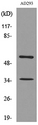 IFNAR2 Antibody - Western blot analysis of lysate from AD293 cells, using IFNAR2 Antibody.