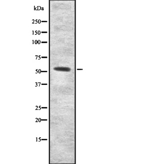 IFNAR2 Antibody - Western blot analysis of INAR2 expression in HEK293 cells. The lane on the left is treated with the antigen-specific peptide.