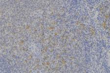 IFNAR2 Antibody - 1:100 staining human lymph node tissue by IHC-P. The sample was formaldehyde fixed and a heat mediated antigen retrieval step in citrate buffer was performed. The sample was then blocked and incubated with the antibody for 1.5 hours at 22°C. An HRP conjugated goat anti-rabbit antibody was used as the secondary.