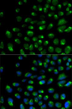 IFNAR2 Antibody - Immunofluorescence analysis of U2OS cells using IFNAR2 Polyclonal Antibody.
