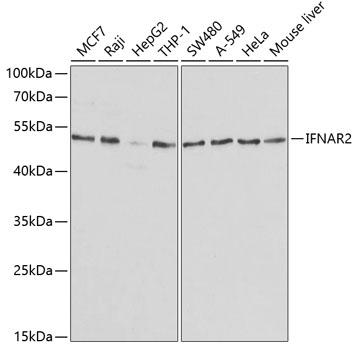 IFNAR2 Antibody - Western blot analysis of extracts of various cell lines using IFNAR2 Polyclonal Antibody at dilution of 1:1000.