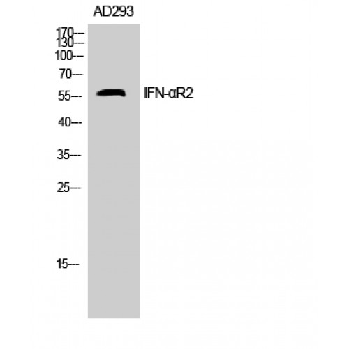 IFNAR2 Antibody - Western blot of IFN-alphaR2 antibody