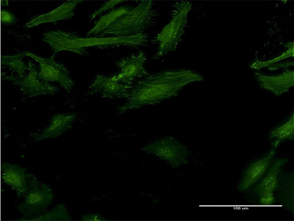 IFNGR2 Antibody - Immunofluorescence of monoclonal antibody to IFNGR2 on HeLa cell . [antibody concentration 10 ug/ml]