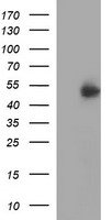 IFNGR2 Antibody - HEK293T cells were transfected with the pCMV6-ENTRY control (Left lane) or pCMV6-ENTRY IFNGR2 (Right lane) cDNA for 48 hrs and lysed. Equivalent amounts of cell lysates (5 ug per lane) were separated by SDS-PAGE and immunoblotted with anti-IFNGR2.