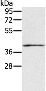 IFNGR2 Antibody - Western blot analysis of Mouse muscle tissue, using IFNGR2 Polyclonal Antibody at dilution of 1:200.