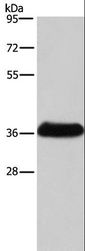 IFNGR2 Antibody - Western blot analysis of Mouse skeletal muscle tissue, using IFNGR2 Polyclonal Antibody at dilution of 1:400.