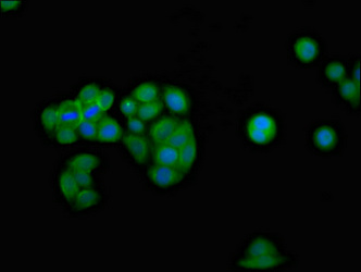 IFNGR2 Antibody - Immunofluorescence staining of PC3 cells at a dilution of 1:133, counter-stained with DAPI. The cells were fixed in 4% formaldehyde, permeabilized using 0.2% Triton X-100 and blocked in 10% normal Goat Serum. The cells were then incubated with the antibody overnight at 4 °C.The secondary antibody was Alexa Fluor 488-congugated AffiniPure Goat Anti-Rabbit IgG (H+L) .