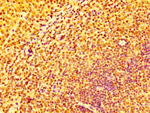IFNGR2 Antibody - Immunohistochemistry image at a dilution of 1:100 and staining in paraffin-embedded human tonsil tissue performed on a Leica BondTM system. After dewaxing and hydration, antigen retrieval was mediated by high pressure in a citrate buffer (pH 6.0) . Section was blocked with 10% normal goat serum 30min at RT. Then primary antibody (1% BSA) was incubated at 4 °C overnight. The primary is detected by a biotinylated secondary antibody and visualized using an HRP conjugated SP system.