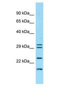 IFNK Antibody - IFNK antibody Western Blot of HT1080. Antibody dilution: 1 ug/ml.  This image was taken for the unconjugated form of this product. Other forms have not been tested.