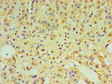 IFNL1 / IL29 Antibody - Immunohistochemistry of paraffin-embedded human adrenal gland using antibody at 1:100 dilution.  This image was taken for the unconjugated form of this product. Other forms have not been tested.