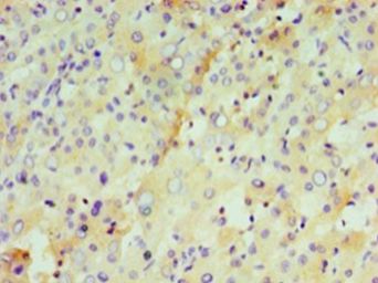 IFNL1 / IL29 Antibody - Immunohistochemistry of paraffin-embedded human liver tissue gland using antibody at 1:100 dilution.  This image was taken for the unconjugated form of this product. Other forms have not been tested.