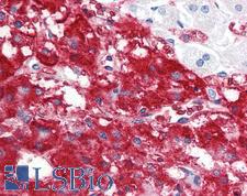 IFNL1 / IL29 Antibody - Anti-IFNL1 / IL29 antibody IHC staining of human adrenal. Immunohistochemistry of formalin-fixed, paraffin-embedded tissue after heat-induced antigen retrieval.  This image was taken for the unconjugated form of this product. Other forms have not been tested.