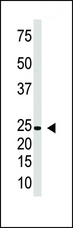 IFNL1 / IL29 Antibody - The anti-IL29 antibody is used in Western blot to detect IL29 in Jurkat cell lysate.