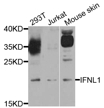 IFNL1 / IL29 Antibody - Western blot blot of extract of various cells, using IFNL1 antibody.