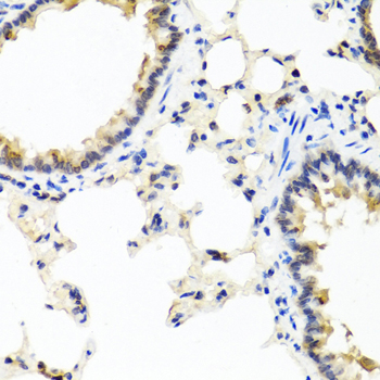 IFNL1 / IL29 Antibody - Immunohistochemistry of paraffin-embedded rat lung using IFNL1 antibody at dilution of 1:100 (40x lens).