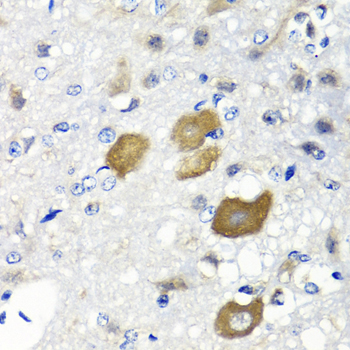 IFNL1 / IL29 Antibody - Immunohistochemistry of paraffin-embedded rat brain using IFNL1 antibody at dilution of 1:100 (40x lens).