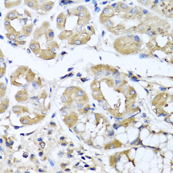 IFNL1 / IL29 Antibody - Immunohistochemistry of paraffin-embedded human stomach using IFNL1 antibody at dilution of 1:100 (40x lens).