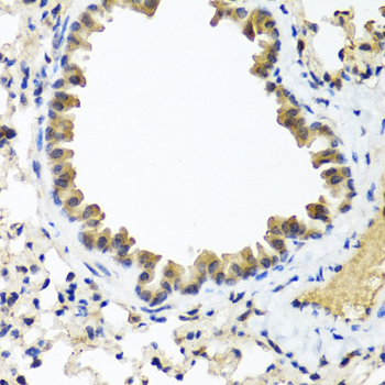 IFNL1 / IL29 Antibody - Immunohistochemistry of paraffin-embedded mouse lung using IFNL1 antibody at dilution of 1:100 (40x lens).