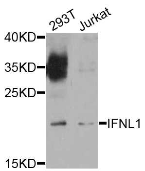 IFNL1 / IL29 Antibody - Western blot analysis of extract of various cells.