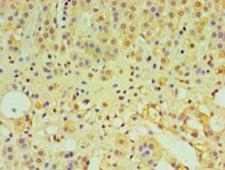 IFNL1 / IL29 Antibody - Immunohistochemistry of paraffin-embedded human adrenal gland at dilution 1:100