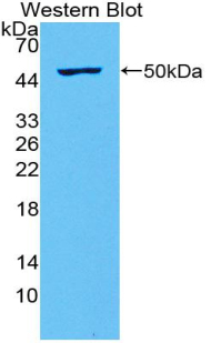 IFNL2 / IL28A Antibody - Western blot of recombinant IL28A.