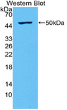 IFNL2 / IL28A Antibody - Western blot of recombinant IL28A.