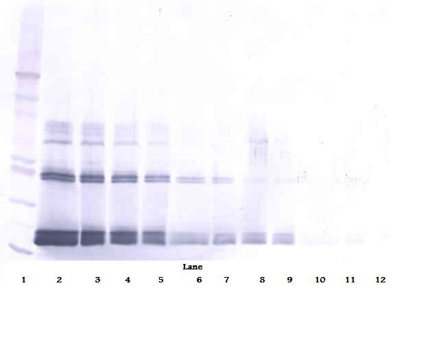IFNL2 / IL28A Antibody - Biotinylated Anti-Human IFN-?2 Western Blot Reduced