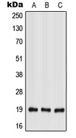 IFNL2 / IL28A Antibody - Western blot analysis of IL-28A expression in HEK293T (A); Raw264.7 (B); rat liver (C) whole cell lysates.