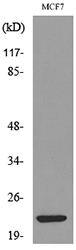 IFNL2 / IL28A Antibody - Western blot analysis of lysate from MCF7 cells, using IL28A Antibody.