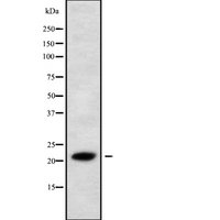 IFNL2 / IL28A Antibody - Western blot analysis IL28A using 293 whole cells lysates
