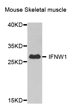 IFNW1 Antibody - Western blot analysis of extract of various cells.