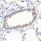 IFNW1 Antibody - Immunohistochemistry of paraffin-embedded rat lung tissue.