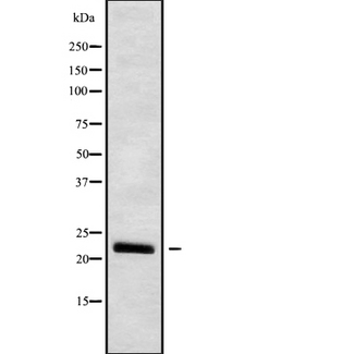 IFNW1 Antibody - Western blot analysis IFNW1 using HuvEc whole cells lysates