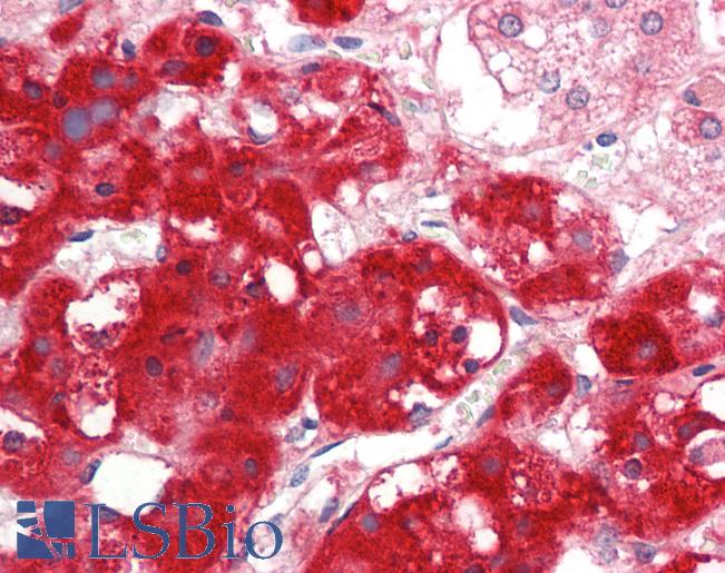 IFRD1 / TIS7 Antibody - Human Adrenal: Formalin-Fixed, Paraffin-Embedded (FFPE).  This image was taken for the unconjugated form of this product. Other forms have not been tested.